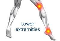 Lower extremities